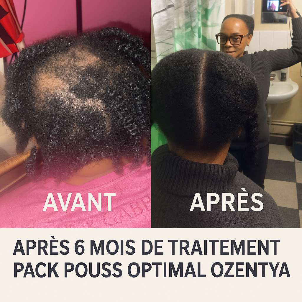 2 Packs Pouss’ Optimal – La Cure Essentielle pour Rebooster Vos Cheveux en Profondeur