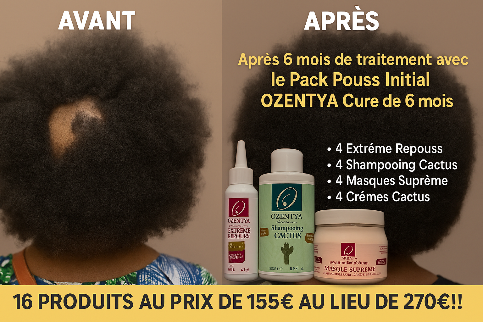 Cure de 6 Mois à -43% : Boostez Votre Pousse à Prix Mini !