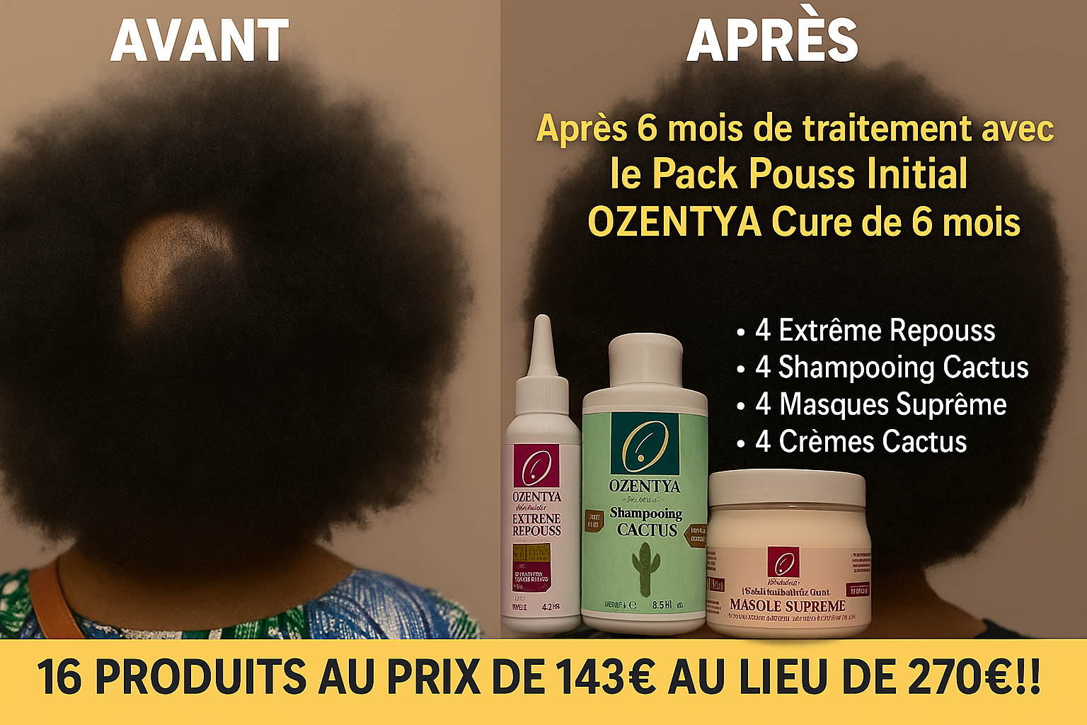 Cure de 6 Mois à -47% : Boostez Votre Pousse à Prix Mini !
